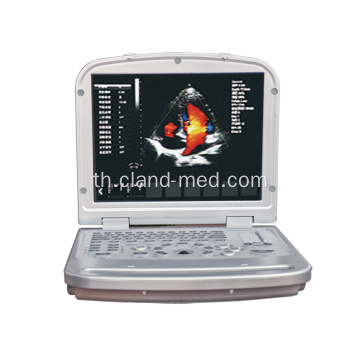 แล็ปท็อปที่มีคุณภาพสูง 4d แบบพกพาสี Doppler เครื่องอัลตราซาวด์